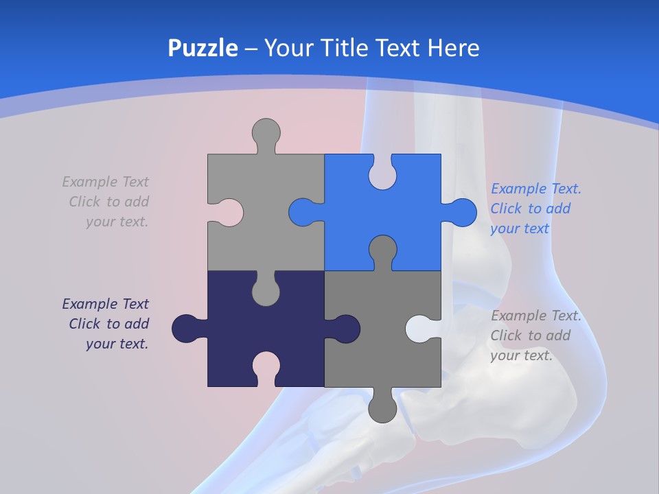 A Medical Powerpoint Presentation With A Skeleton PowerPoint Template