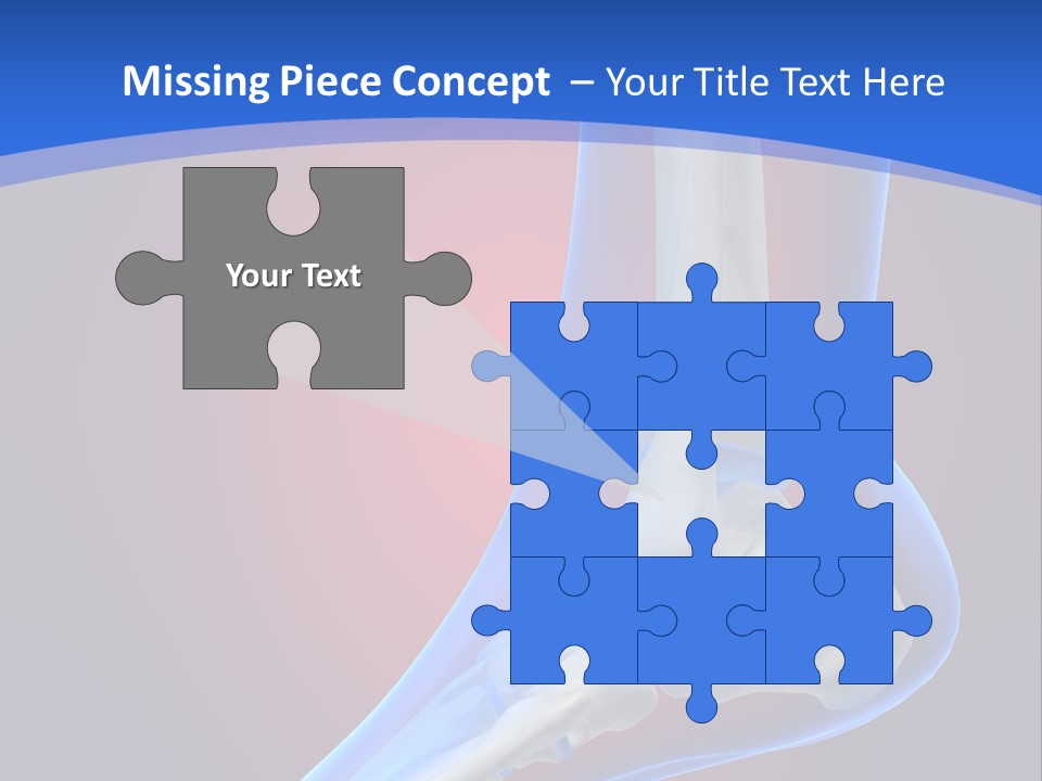 A Medical Powerpoint Presentation With A Skeleton PowerPoint Template