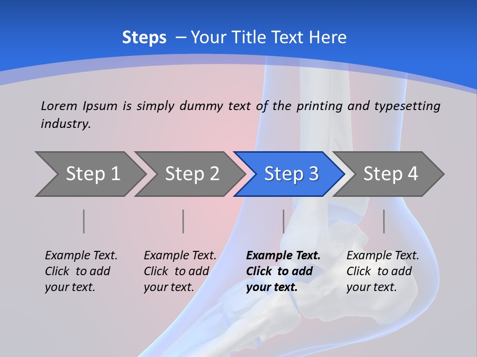 A Medical Powerpoint Presentation With A Skeleton PowerPoint Template