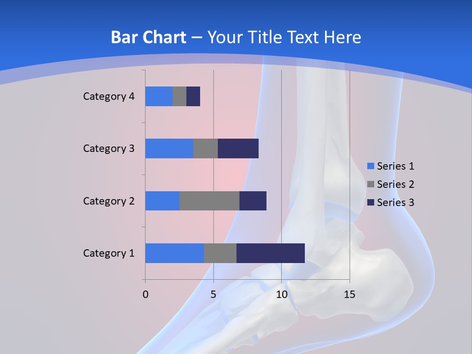 A Medical Powerpoint Presentation With A Skeleton PowerPoint Template