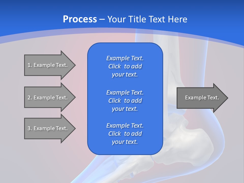 A Medical Powerpoint Presentation With A Skeleton PowerPoint Template