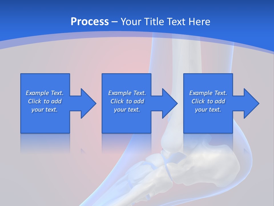 A Medical Powerpoint Presentation With A Skeleton PowerPoint Template