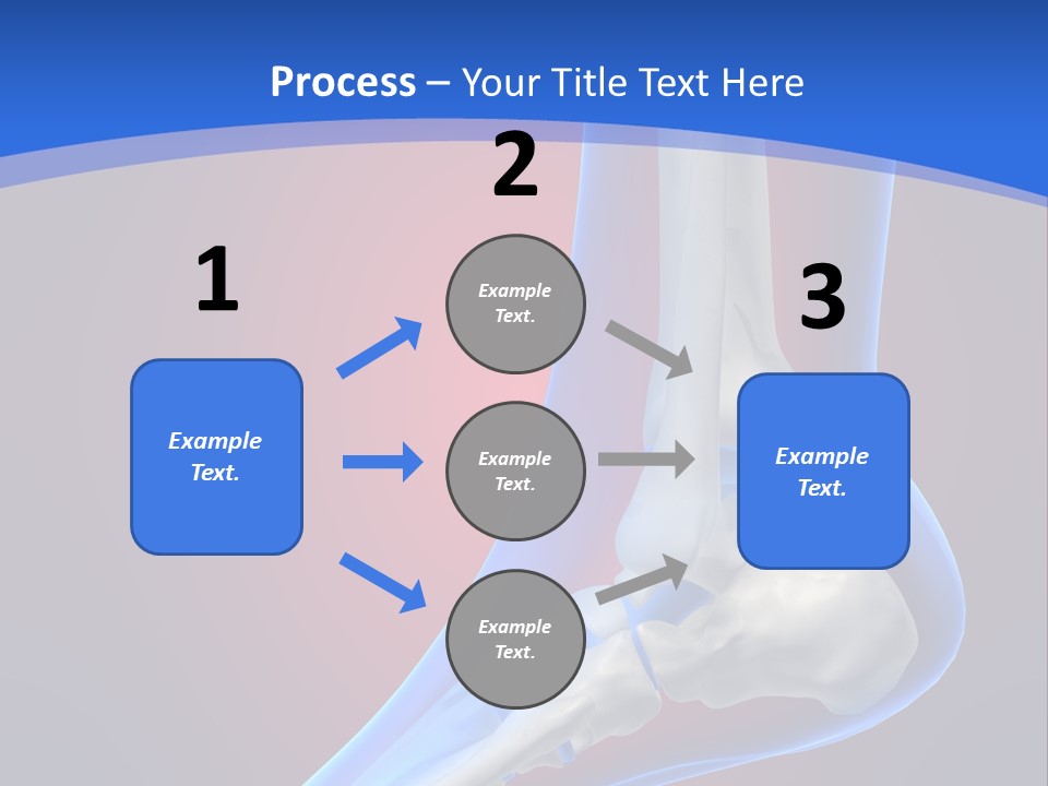 A Medical Powerpoint Presentation With A Skeleton PowerPoint Template