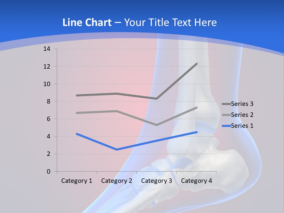 A Medical Powerpoint Presentation With A Skeleton PowerPoint Template