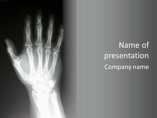 A Skeleton Hand Is Shown In This Presentation PowerPoint Template