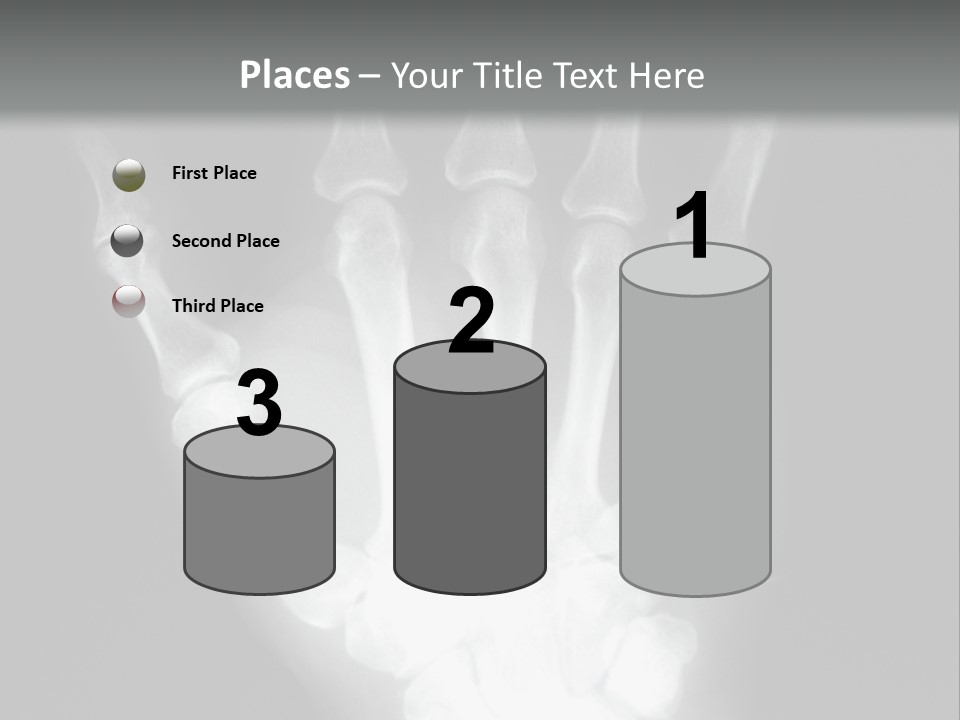 A Skeleton Hand Is Shown In This Presentation PowerPoint Template