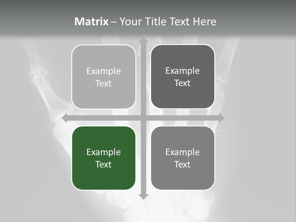A Skeleton Hand Is Shown In This Presentation PowerPoint Template