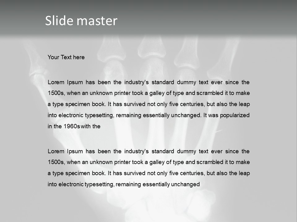 A Skeleton Hand Is Shown In This Presentation PowerPoint Template