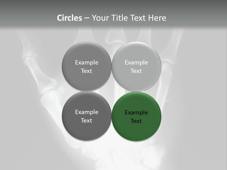 A Skeleton Hand Is Shown In This Presentation PowerPoint Template