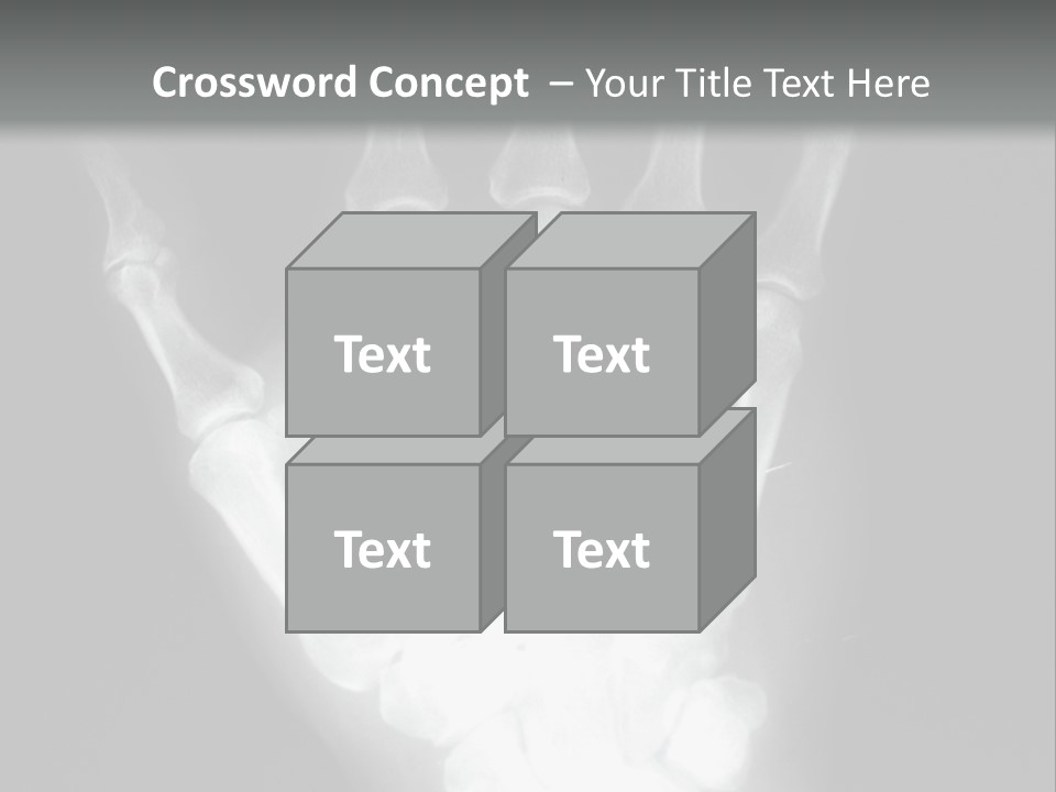 A Skeleton Hand Is Shown In This Presentation PowerPoint Template