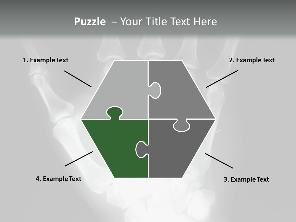A Skeleton Hand Is Shown In This Presentation PowerPoint Template
