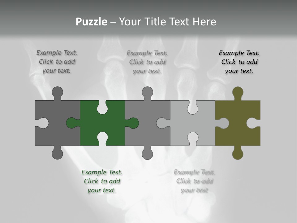 A Skeleton Hand Is Shown In This Presentation PowerPoint Template