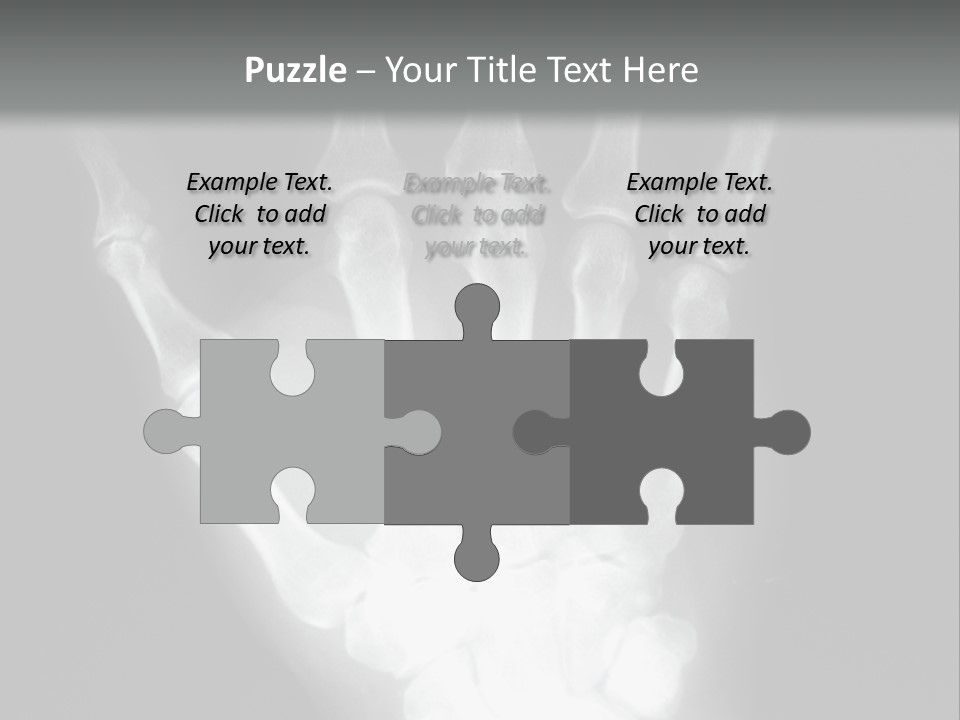 A Skeleton Hand Is Shown In This Presentation PowerPoint Template