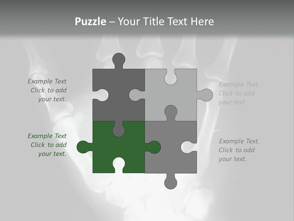 A Skeleton Hand Is Shown In This Presentation PowerPoint Template