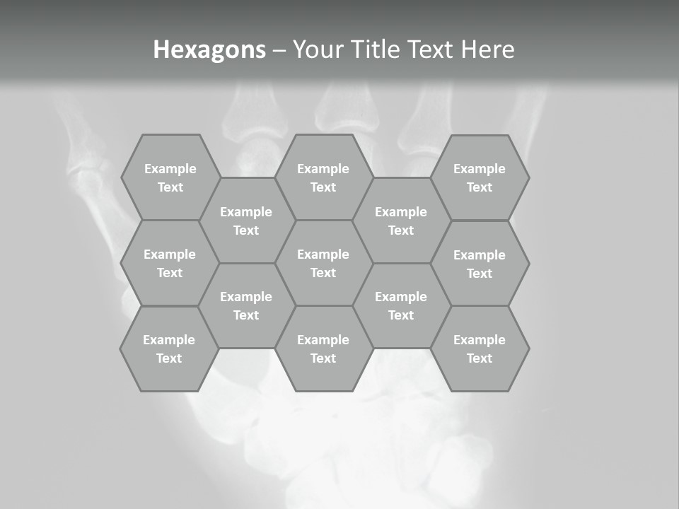A Skeleton Hand Is Shown In This Presentation PowerPoint Template