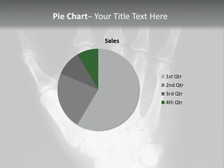 A Skeleton Hand Is Shown In This Presentation PowerPoint Template