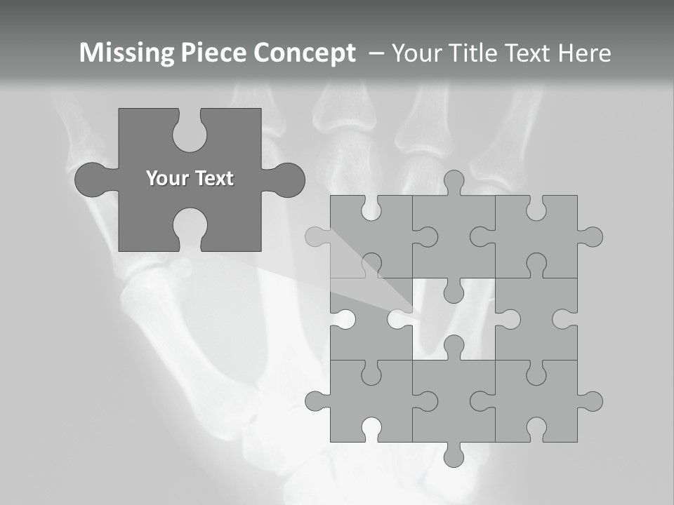 A Skeleton Hand Is Shown In This Presentation PowerPoint Template