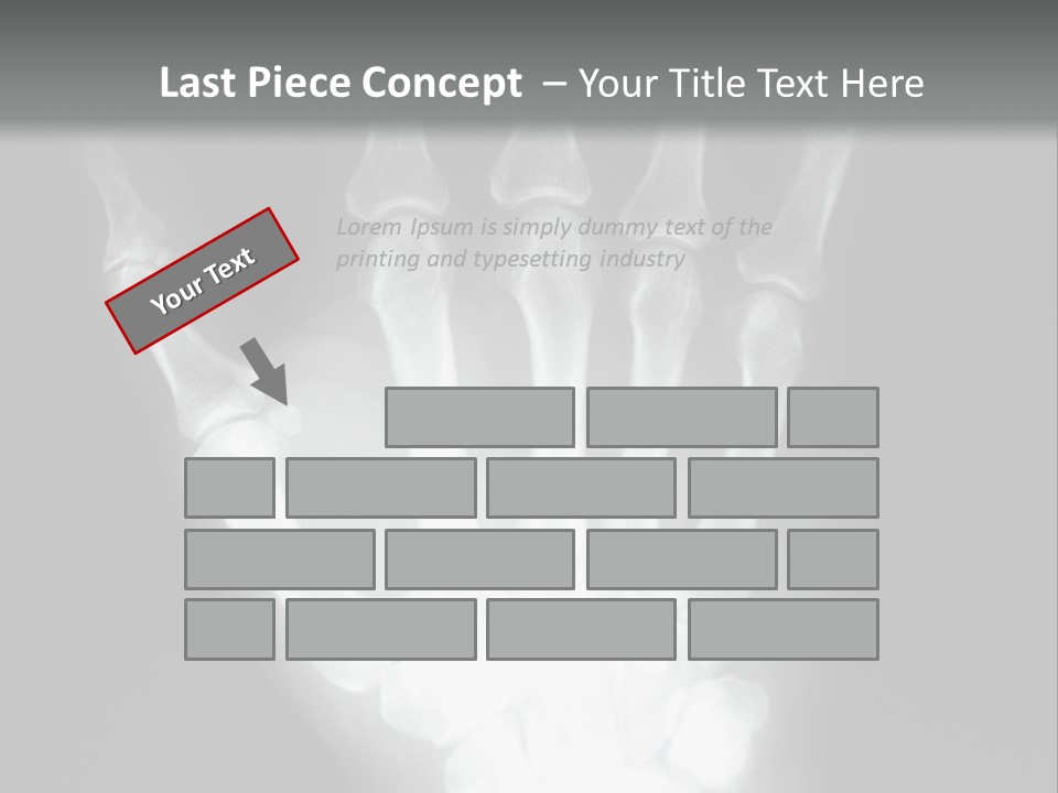 A Skeleton Hand Is Shown In This Presentation PowerPoint Template