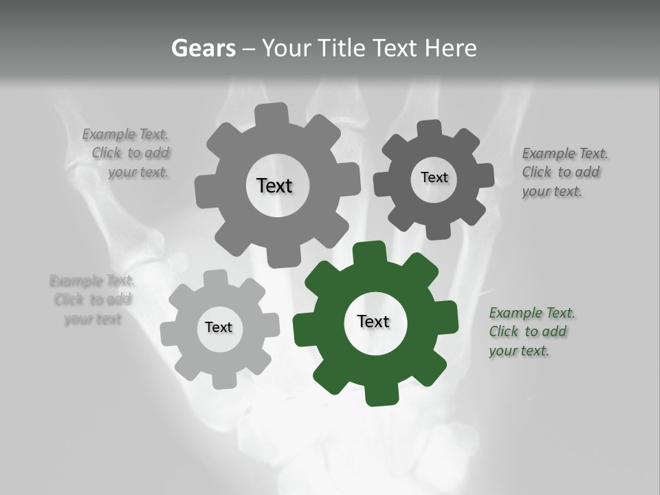 A Skeleton Hand Is Shown In This Presentation PowerPoint Template