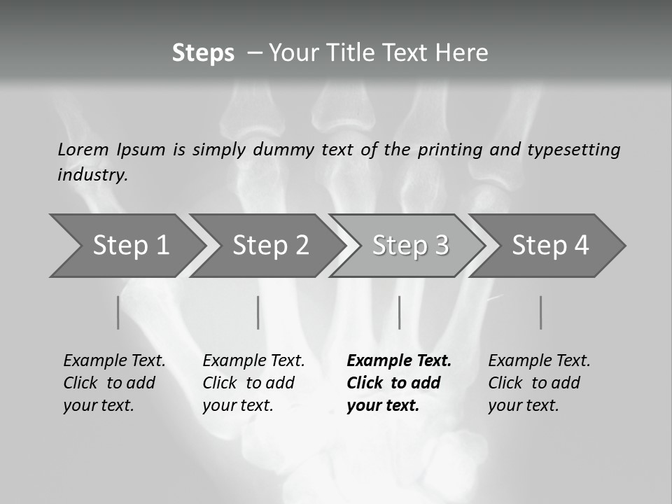 A Skeleton Hand Is Shown In This Presentation PowerPoint Template
