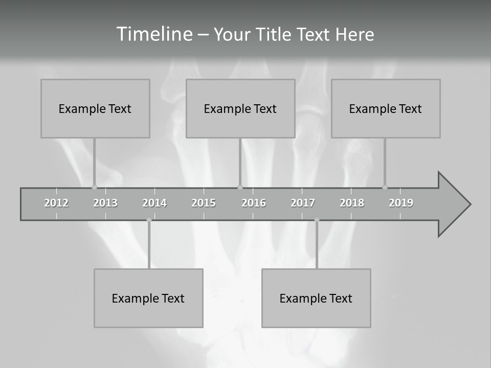 A Skeleton Hand Is Shown In This Presentation PowerPoint Template