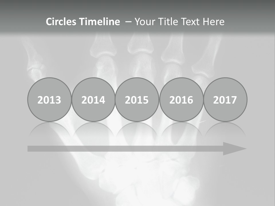 A Skeleton Hand Is Shown In This Presentation PowerPoint Template