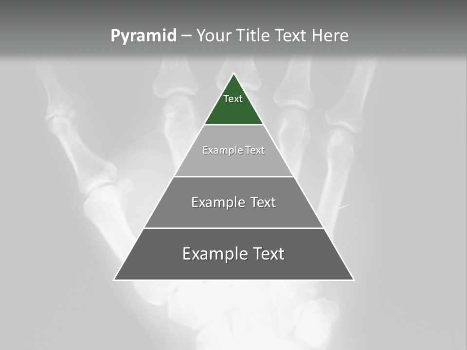 A Skeleton Hand Is Shown In This Presentation PowerPoint Template