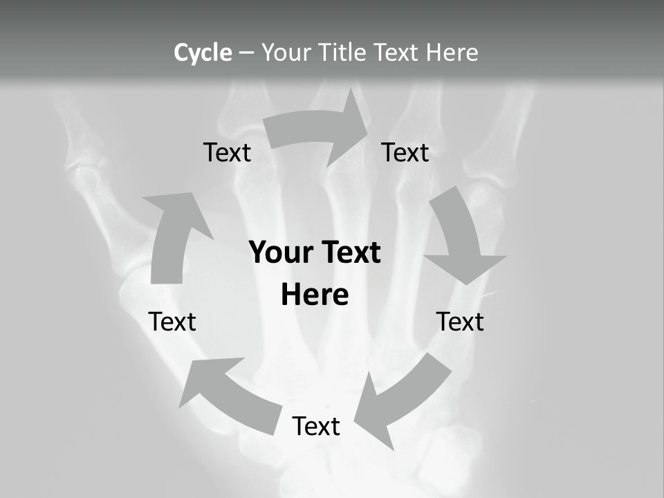 A Skeleton Hand Is Shown In This Presentation PowerPoint Template