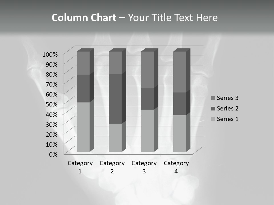 A Skeleton Hand Is Shown In This Presentation PowerPoint Template