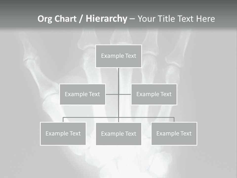 A Skeleton Hand Is Shown In This Presentation PowerPoint Template
