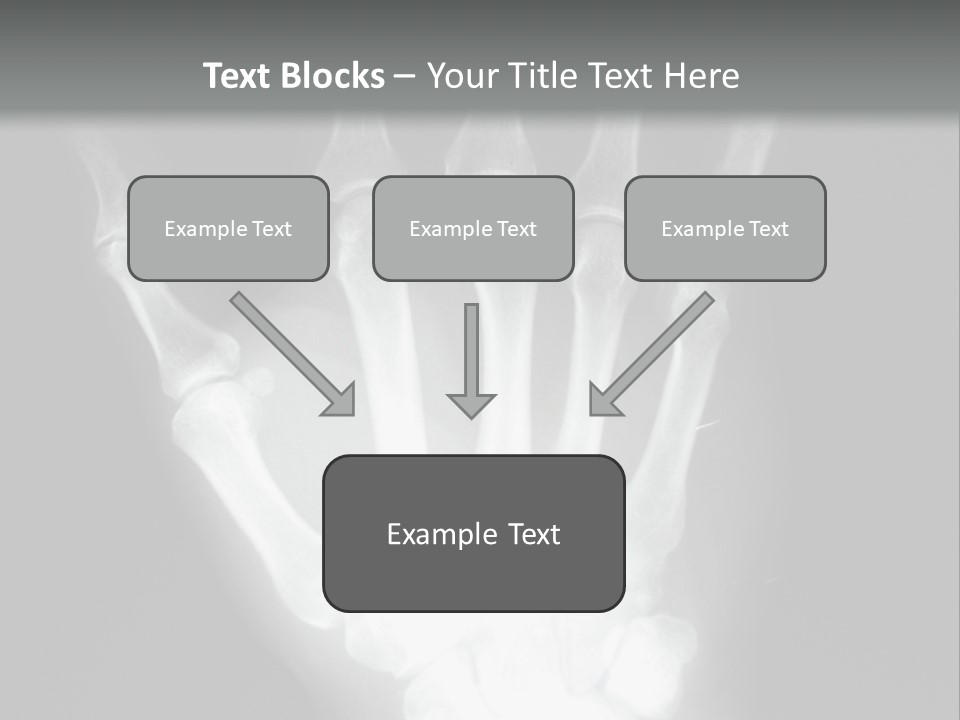 A Skeleton Hand Is Shown In This Presentation PowerPoint Template