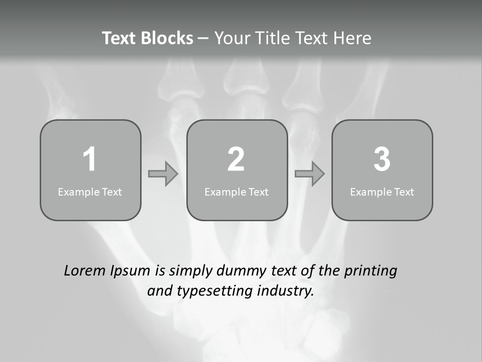 A Skeleton Hand Is Shown In This Presentation PowerPoint Template