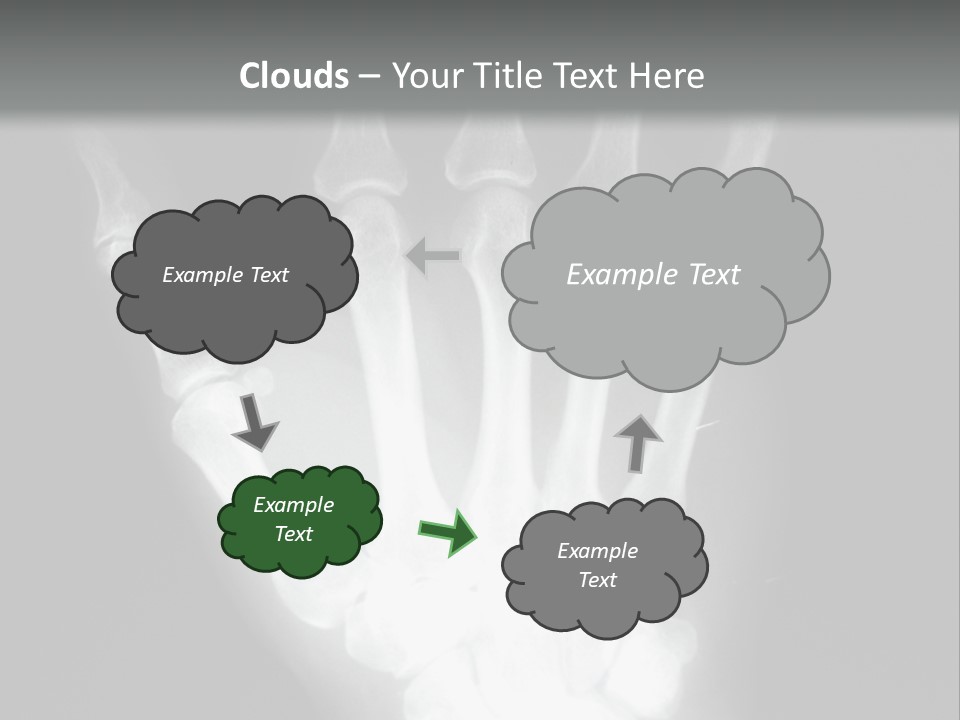 A Skeleton Hand Is Shown In This Presentation PowerPoint Template