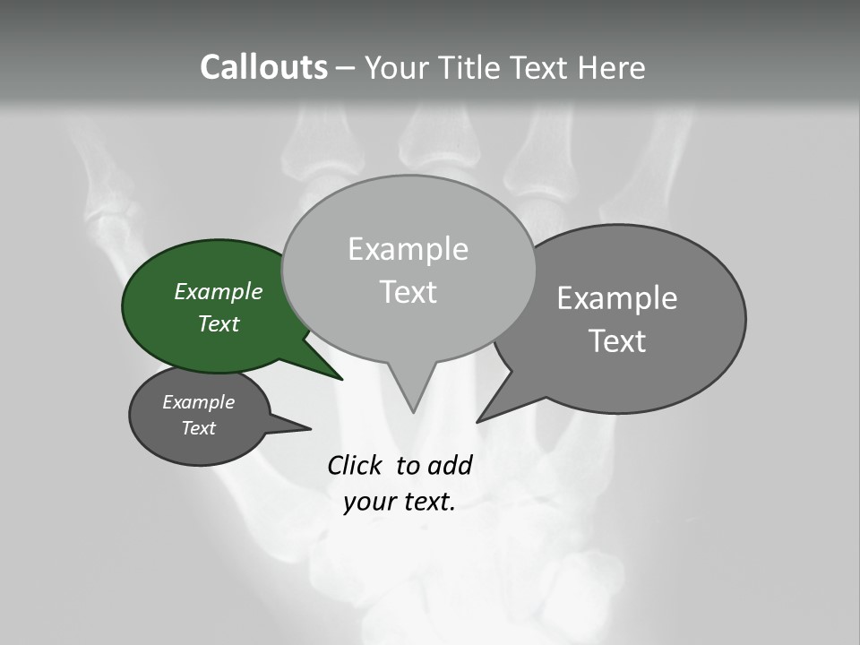 A Skeleton Hand Is Shown In This Presentation PowerPoint Template