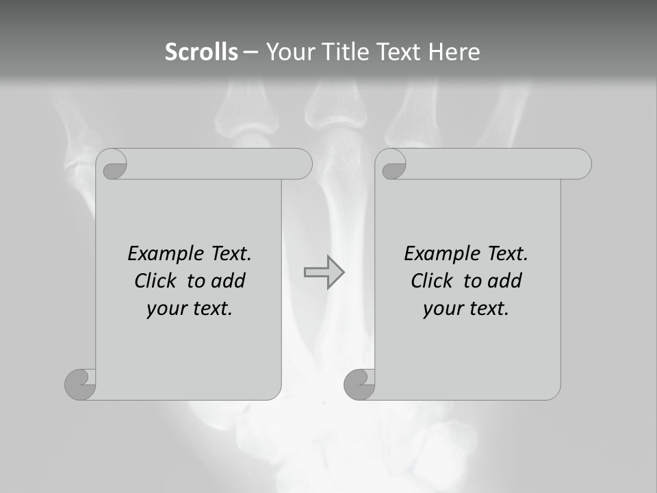 A Skeleton Hand Is Shown In This Presentation PowerPoint Template