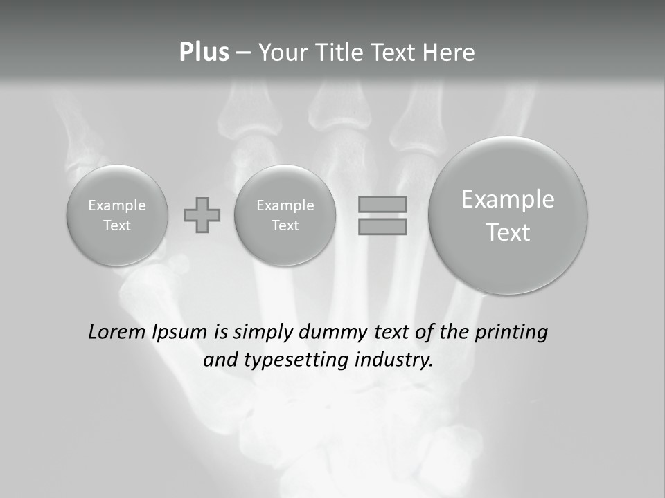 A Skeleton Hand Is Shown In This Presentation PowerPoint Template