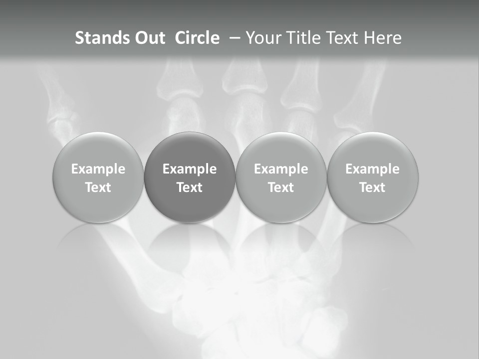 A Skeleton Hand Is Shown In This Presentation PowerPoint Template