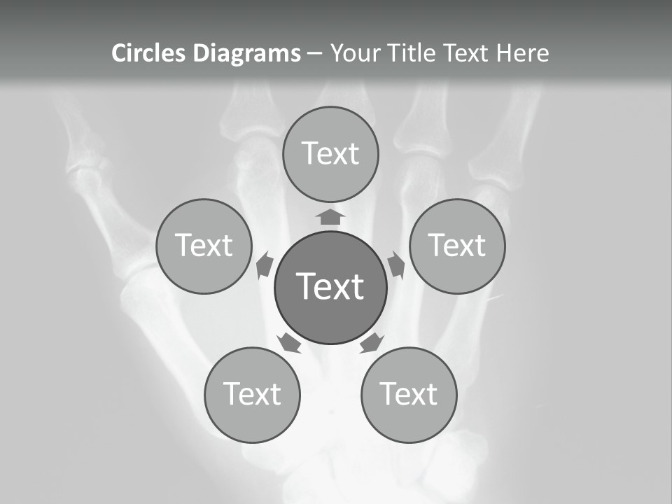 A Skeleton Hand Is Shown In This Presentation PowerPoint Template
