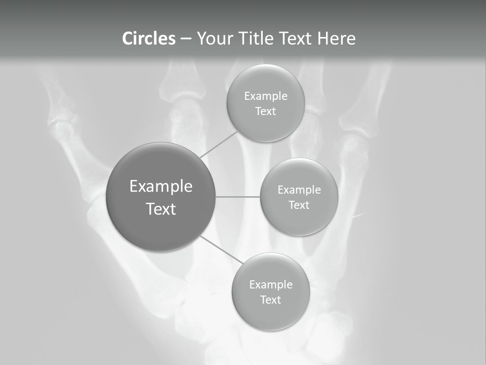 A Skeleton Hand Is Shown In This Presentation PowerPoint Template