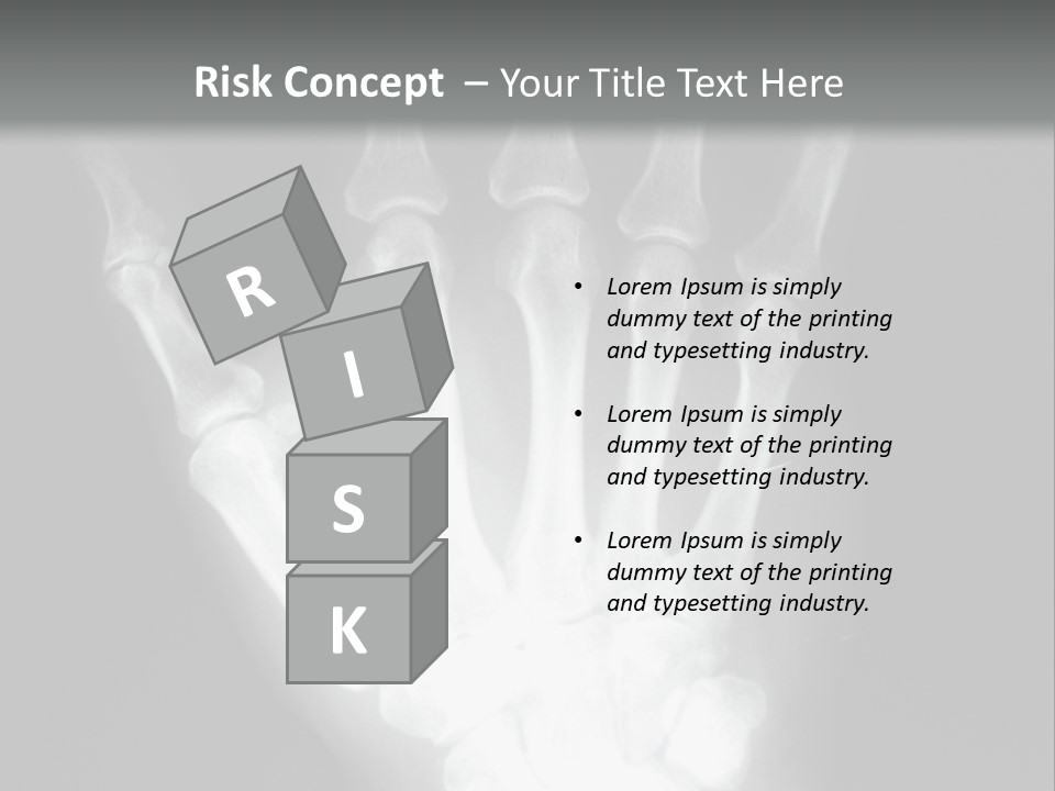 A Skeleton Hand Is Shown In This Presentation PowerPoint Template