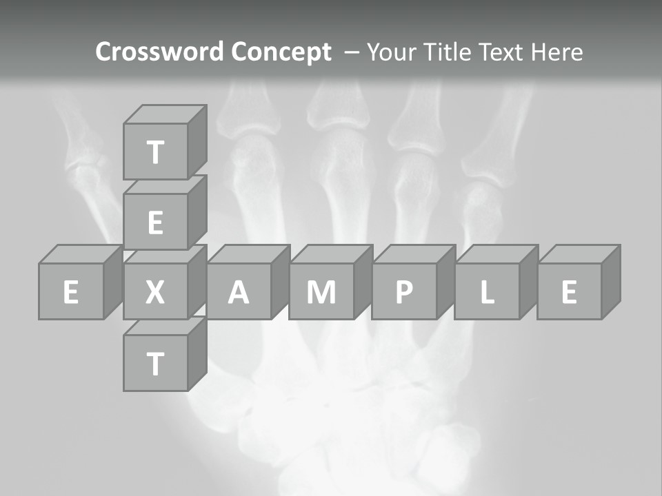 A Skeleton Hand Is Shown In This Presentation PowerPoint Template
