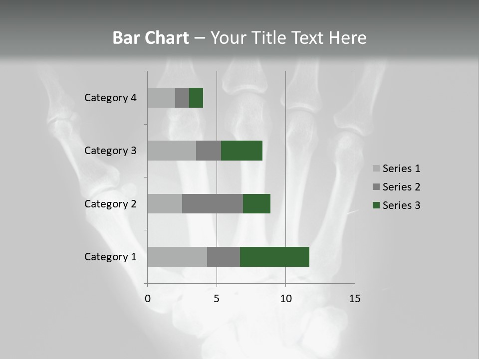 A Skeleton Hand Is Shown In This Presentation PowerPoint Template