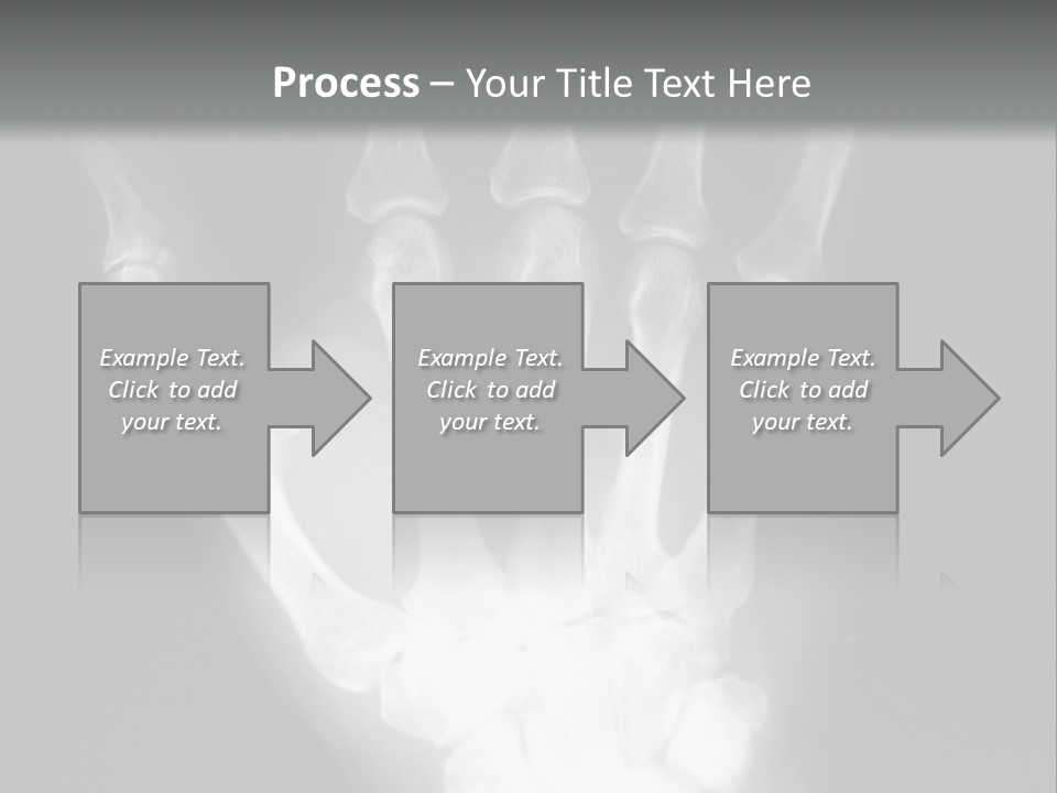A Skeleton Hand Is Shown In This Presentation PowerPoint Template