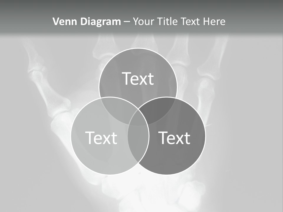 A Skeleton Hand Is Shown In This Presentation PowerPoint Template