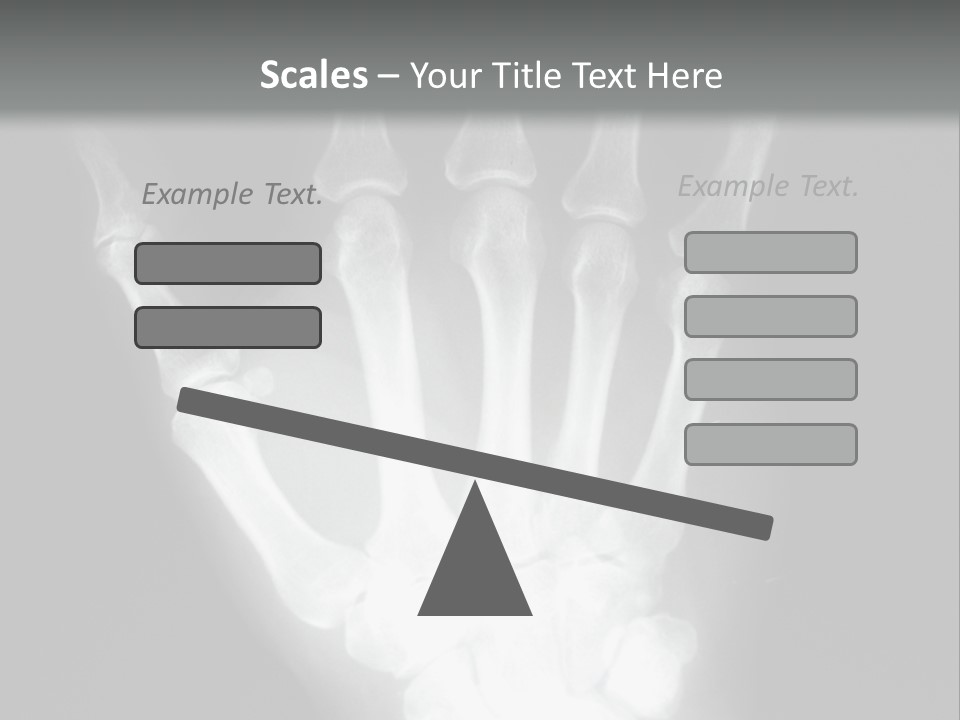 A Skeleton Hand Is Shown In This Presentation PowerPoint Template