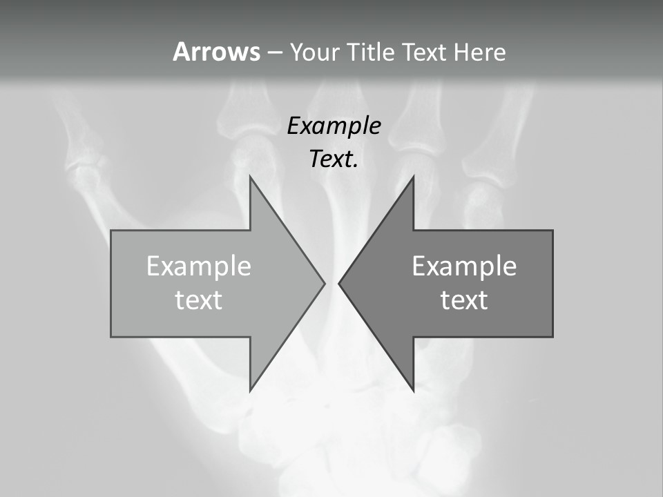 A Skeleton Hand Is Shown In This Presentation PowerPoint Template