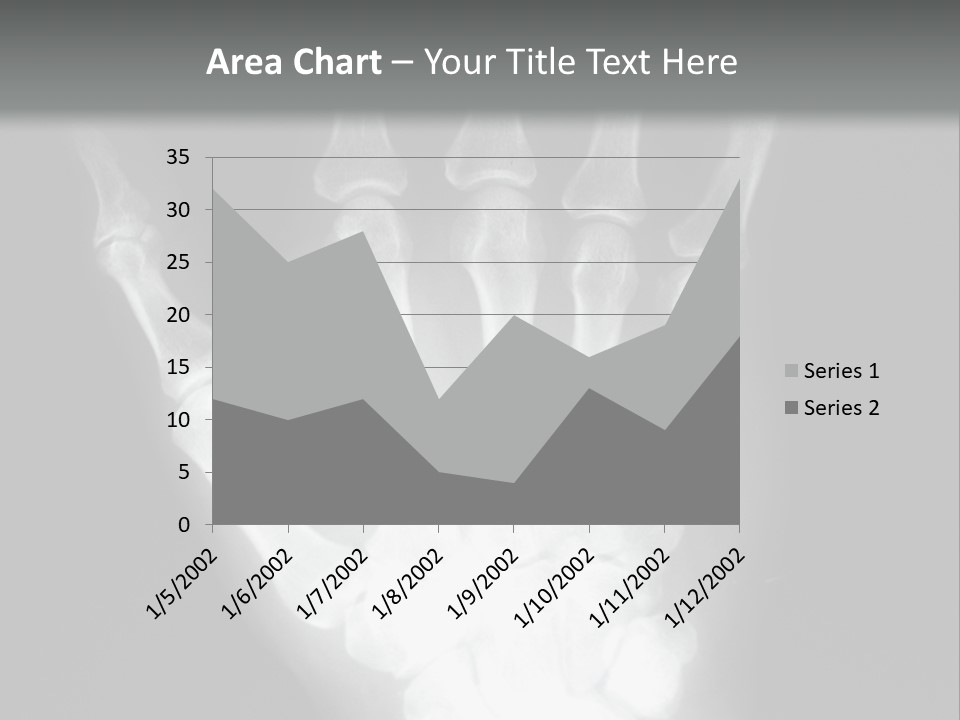 A Skeleton Hand Is Shown In This Presentation PowerPoint Template