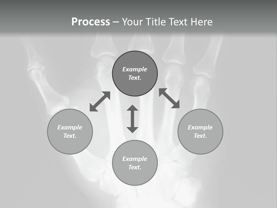 A Skeleton Hand Is Shown In This Presentation PowerPoint Template