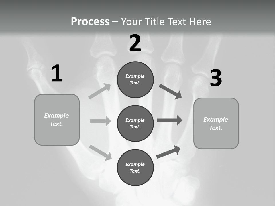 A Skeleton Hand Is Shown In This Presentation PowerPoint Template