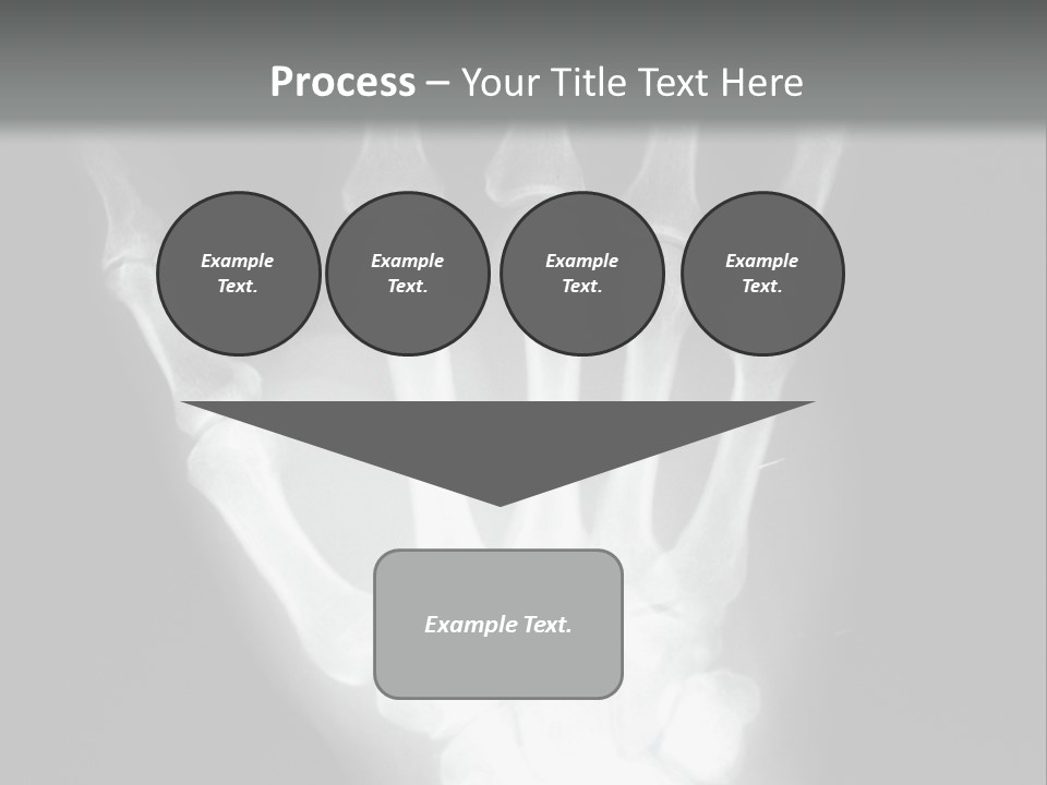 A Skeleton Hand Is Shown In This Presentation PowerPoint Template